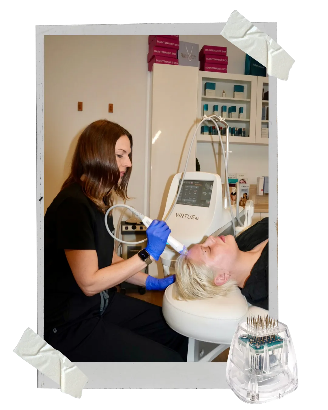 Virtue RF Microneedling candidate